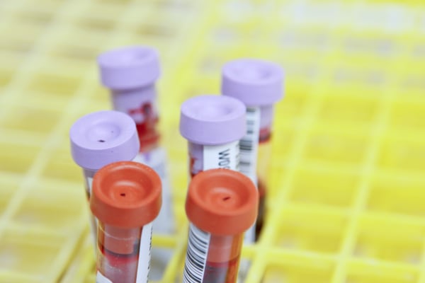 Using Health Data to Improve the Lab Result Experience for Patients